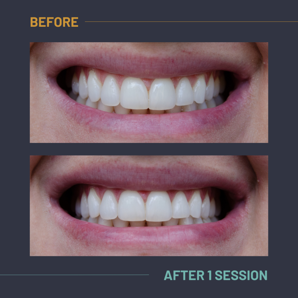 Nuvola_Tonic_Before:After4