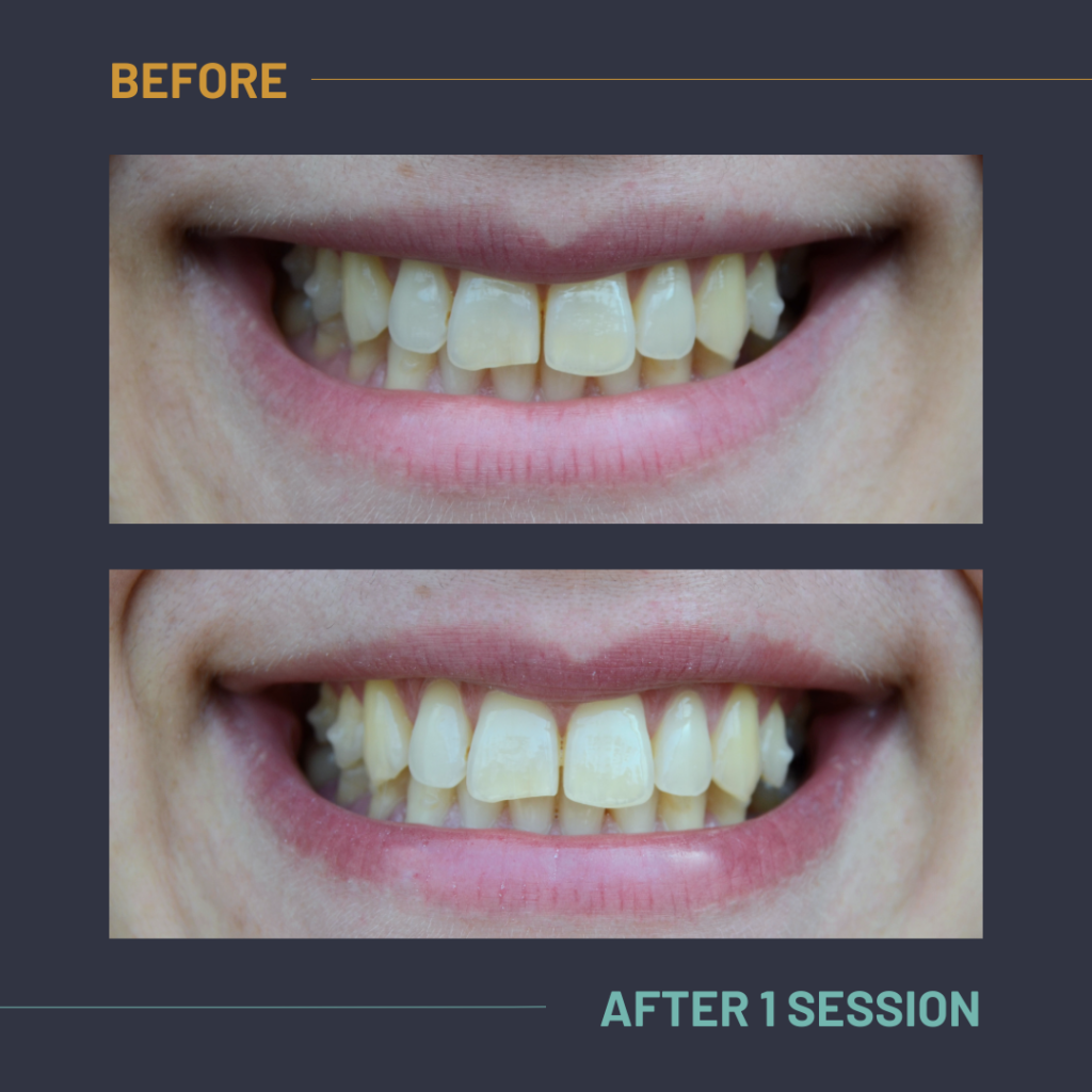 Nuvola_Tonic_Before:After5
