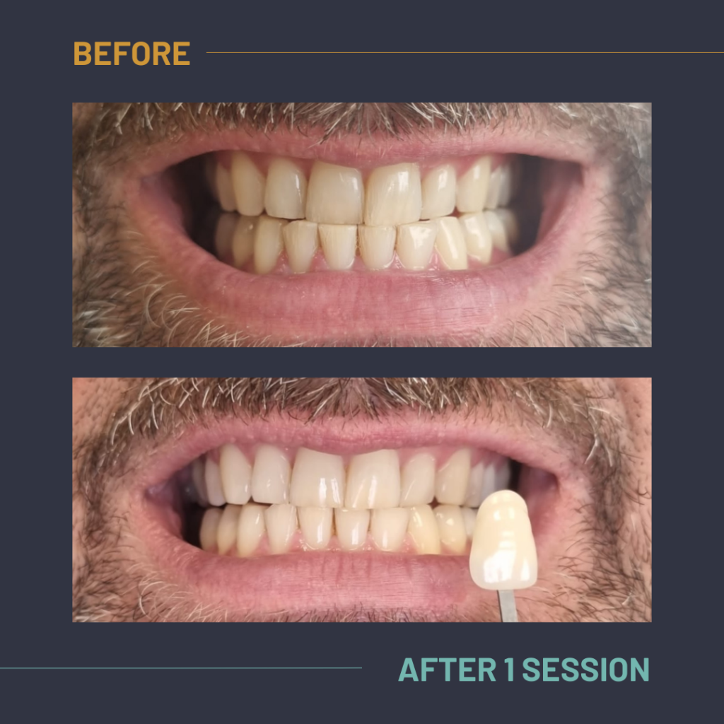 Nuvola_Tonic_Before:After6